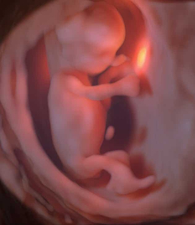 Embryo in der 12. SSW