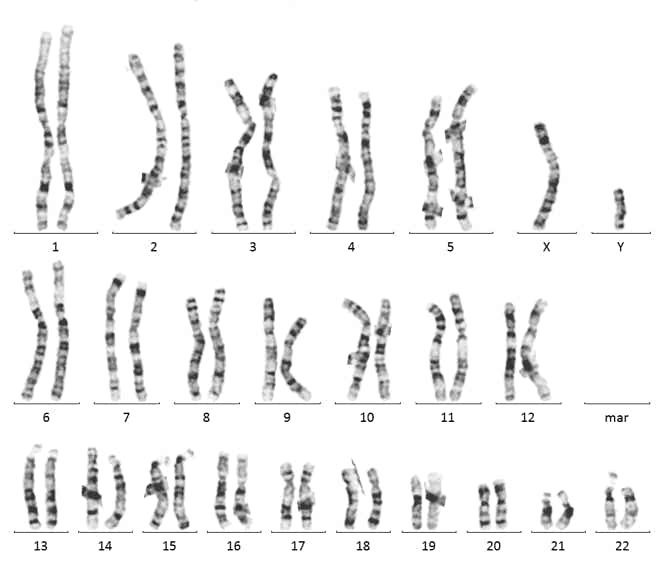 Normaler Chromosomensatz