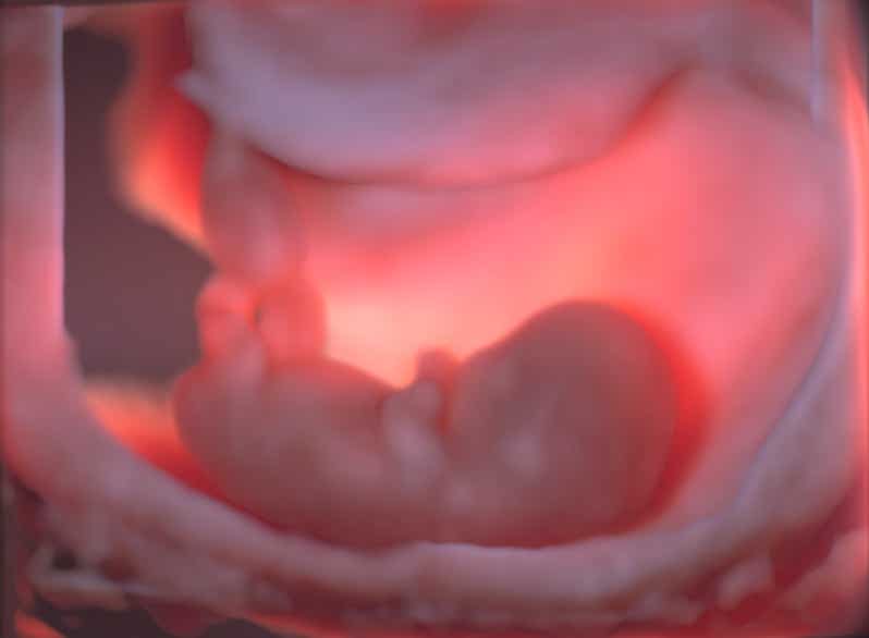 Embryo und Amnionhöhle