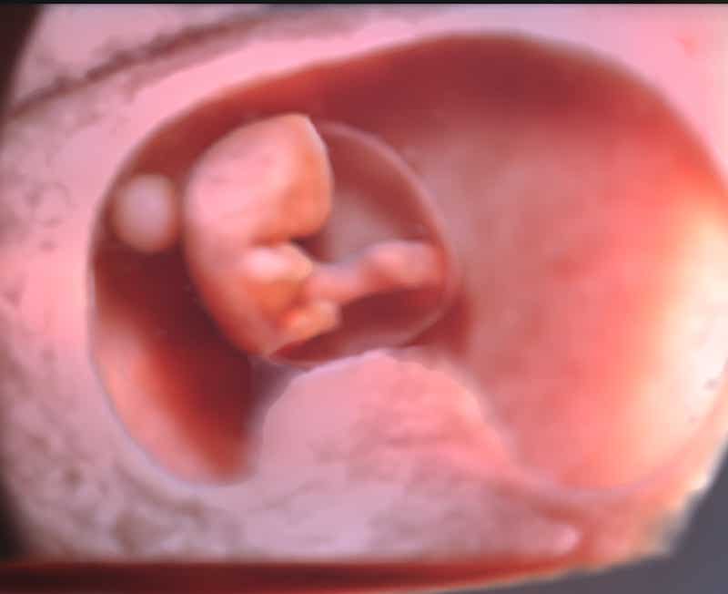 Embryo in der 9. SSW