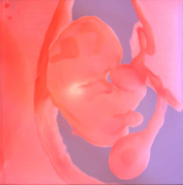 Embryo in der 9. SSW